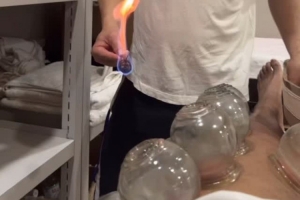 尝试东方神秘力量！北京男篮外援斯佩尔曼晒拔火罐视频